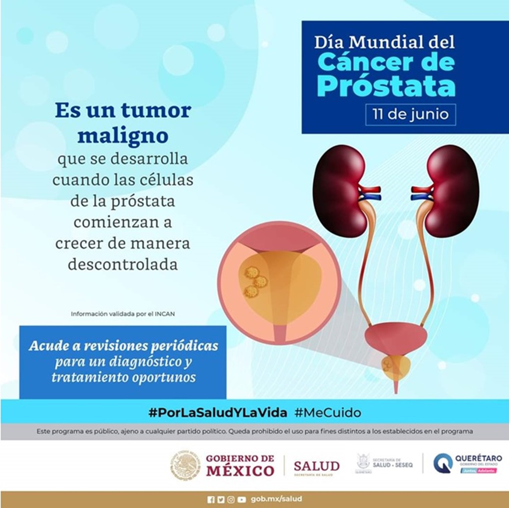 71 273 44479 276486501 1 1106 SESA DIA MUNDIAL CA PROSTATA